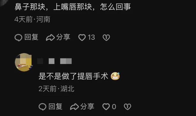 51岁朱迅变化大，上唇外翻疑做提唇手术，分享心灵鸡汤反遭调侃