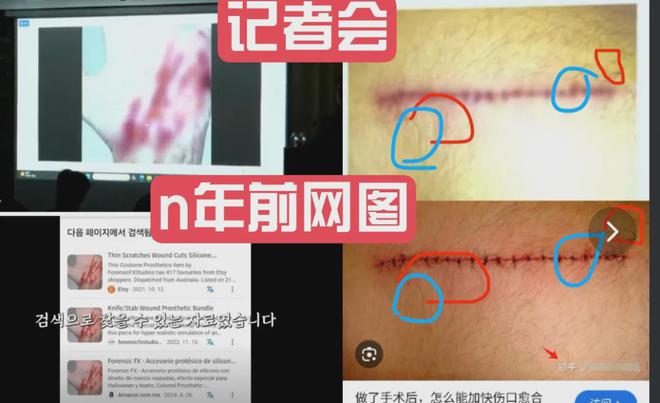 金秀贤否认买凶杀人！称录音和受伤图是伪造，金赛纶家属疑中圈套