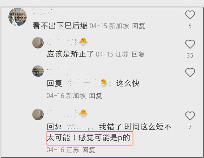 17岁森碟近照引热议，网友直指牙床明显长歪，田亮夫妇又挨批