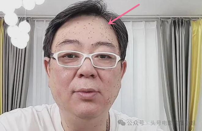 新剧AI换脸，高亚麟被封杀！国民老爸曝出轨丑闻，满脸黑点引猜测