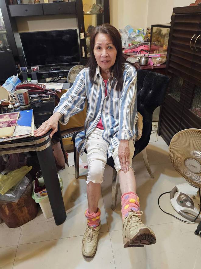 72岁歌后腰椎手术导致左脚瘫痪！晚年生活几乎无法自理