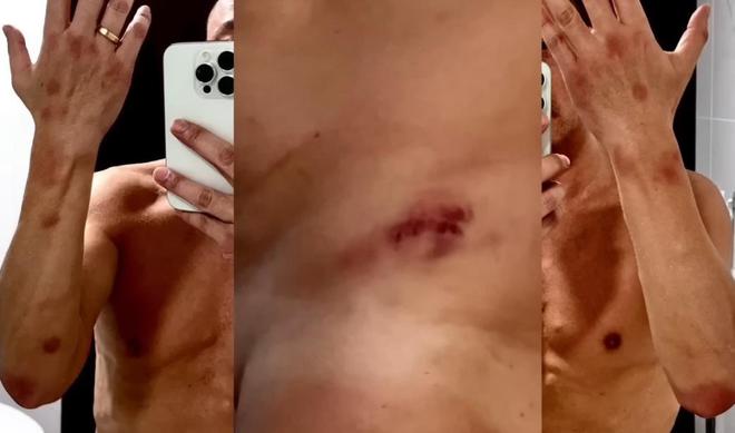 王喜还原遭男友人迷奸细节：两次被下药迷晕，醒来后下半身已失禁