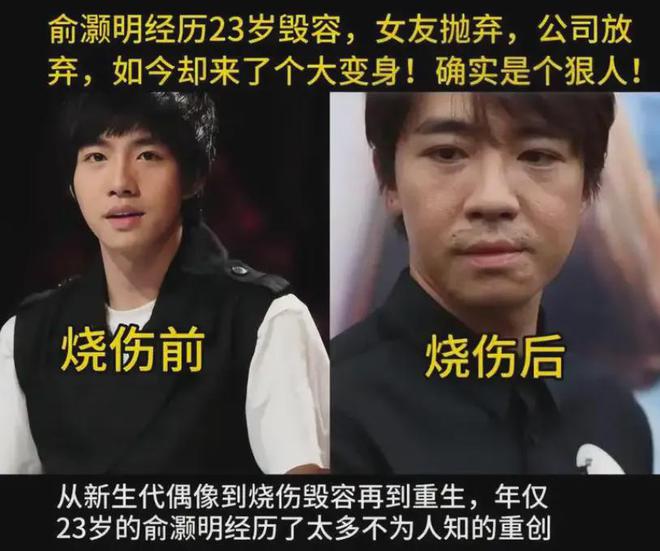 俞灏明被质疑逼婚，网曝恋爱瓜有四十多页，网友担心王晓晨受伤害