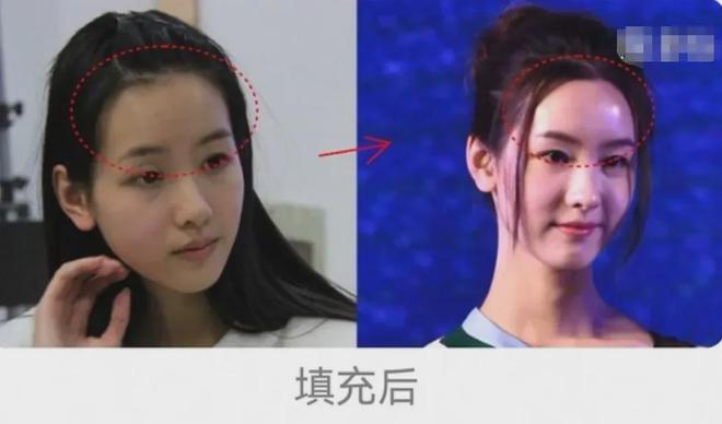 31岁陈都灵现身生图引热议，眉弓突出气质凌厉，脸部馒化越加明显