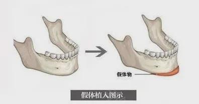 宋祖儿复出二连爆，80斤都不到的她是怎么哭出双下巴的？