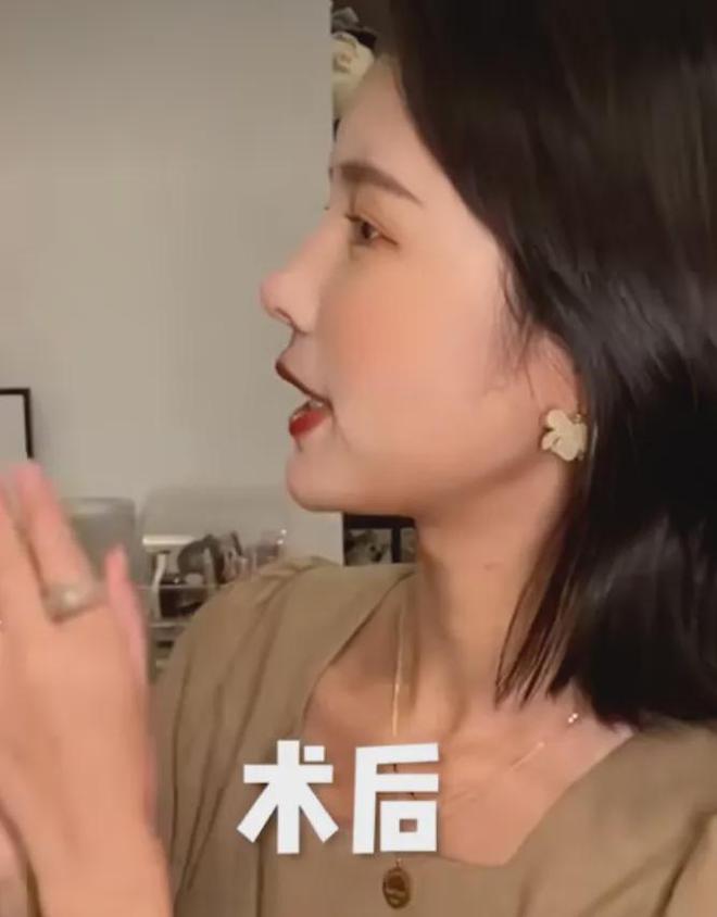宋祖儿复出二连爆，80斤都不到的她是怎么哭出双下巴的？