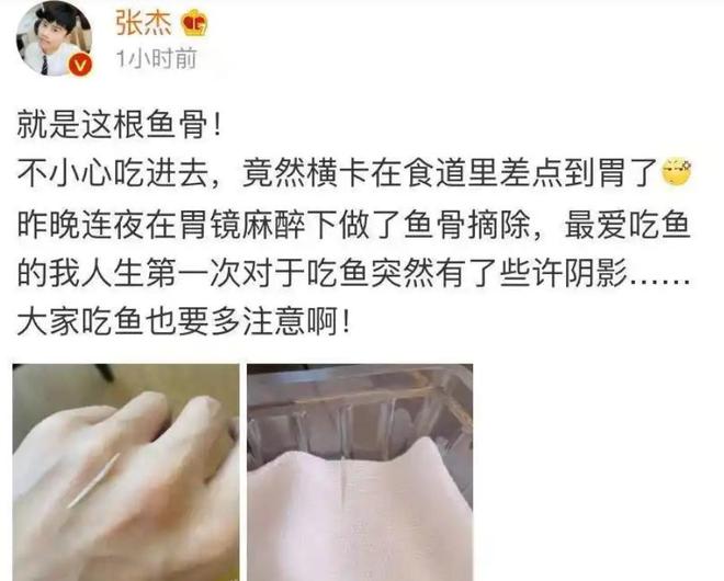 柳岩被鱼刺卡住上热搜？张杰郑恺中过招，丁禹兮从此不敢吃鱼