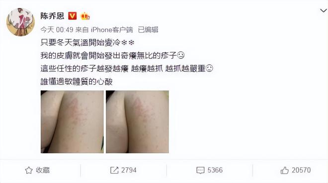 陈乔恩做“针雕”吓坏网友，全身插满上千支钢针，连脚趾也没放过