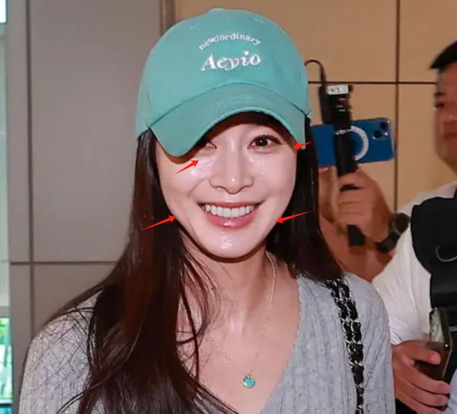 45岁金泰希为医美代言，脸油到反光，曾经的“自然美女”不复存在