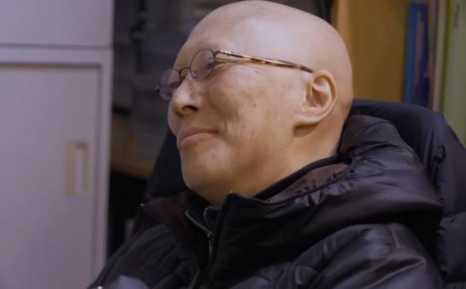 著名男艺人患膀胱癌离世，享年60岁，最后生活照瘦到憔悴不堪
