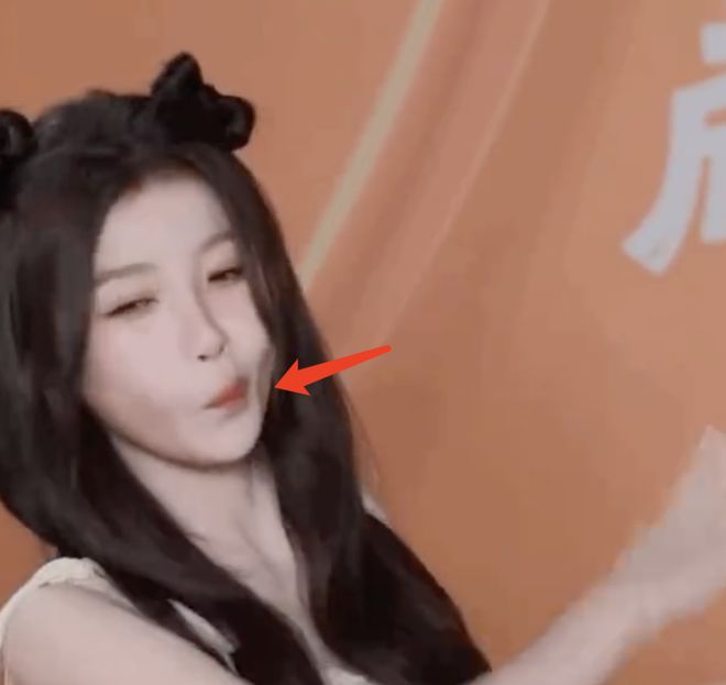 虞书欣的脸怎么了？直播时左脸出现凹陷，被网友质疑医美后遗症