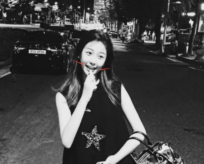 虞书欣的脸怎么了？直播时左脸出现凹陷，被网友质疑医美后遗症
