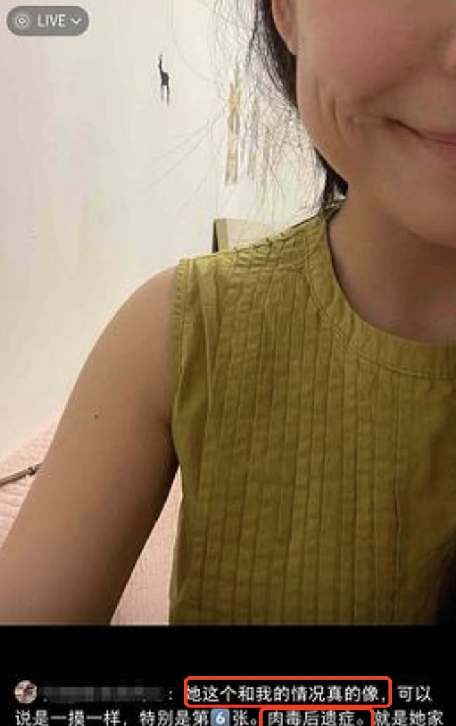虞书欣的脸怎么了？直播时左脸出现凹陷，被网友质疑医美后遗症