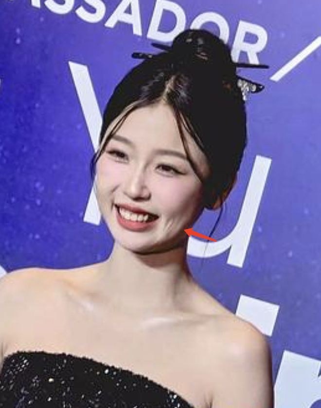 虞书欣的脸怎么了？直播时左脸出现凹陷，被网友质疑医美后遗症