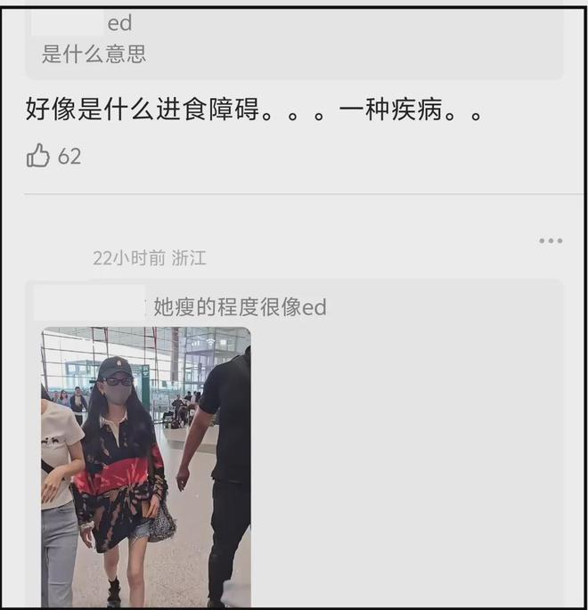 27岁宋祖儿脸部浮肿四肢瘦，疑似进食障碍长期催吐，状态惹人担忧