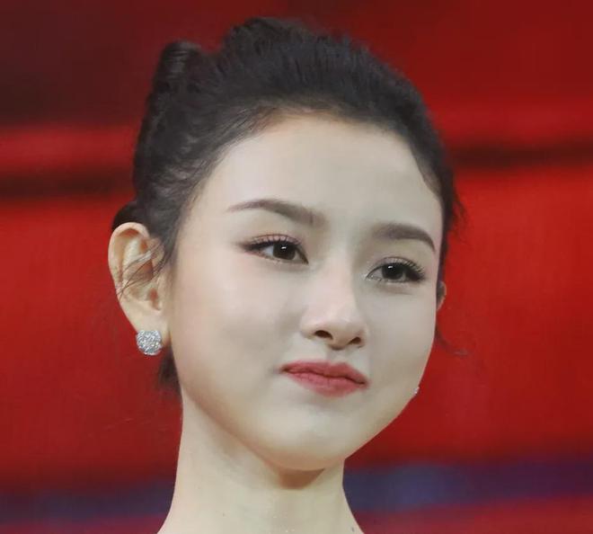 27岁宋祖儿脸部浮肿四肢瘦，疑似进食障碍长期催吐，状态惹人担忧