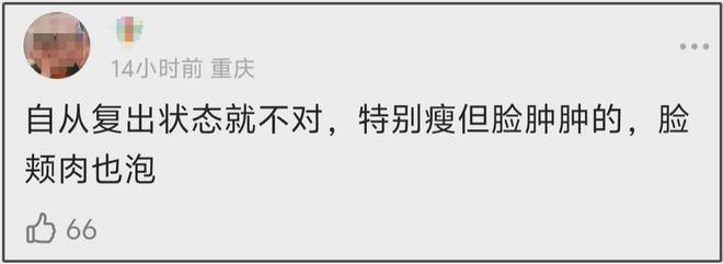 27岁宋祖儿脸部浮肿四肢瘦，疑似进食障碍长期催吐，状态惹人担忧