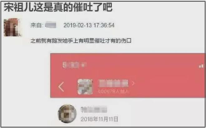 27岁宋祖儿脸部浮肿四肢瘦，疑似进食障碍长期催吐，状态惹人担忧