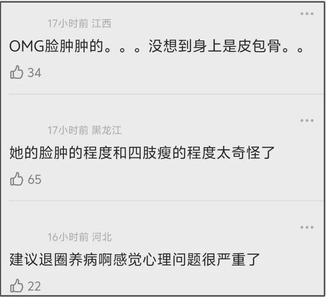 27岁宋祖儿脸部浮肿四肢瘦，疑似进食障碍长期催吐，状态惹人担忧