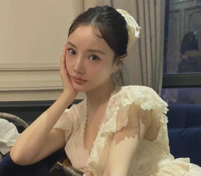 李小璐近照鼻头发黑泛红，43岁了还在追求少女感，彻底变成幼态脸
