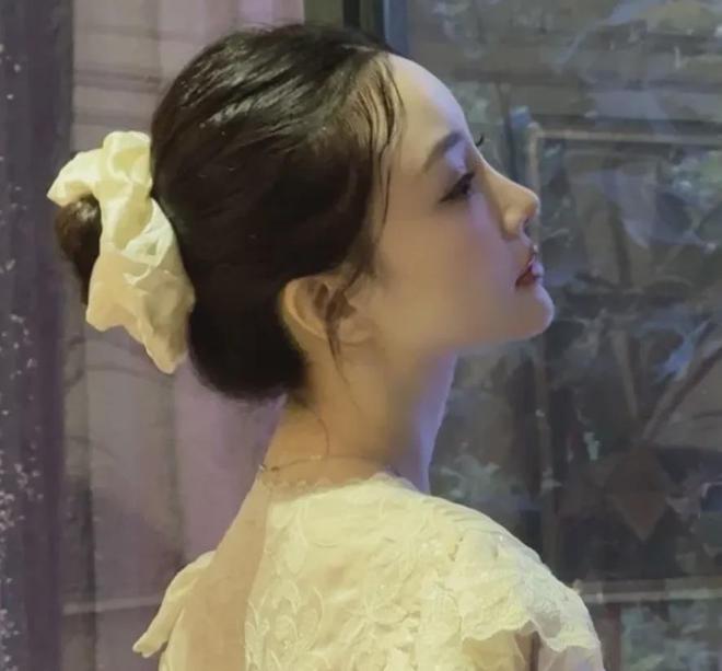 李小璐近照鼻头发黑泛红，43岁了还在追求少女感，彻底变成幼态脸