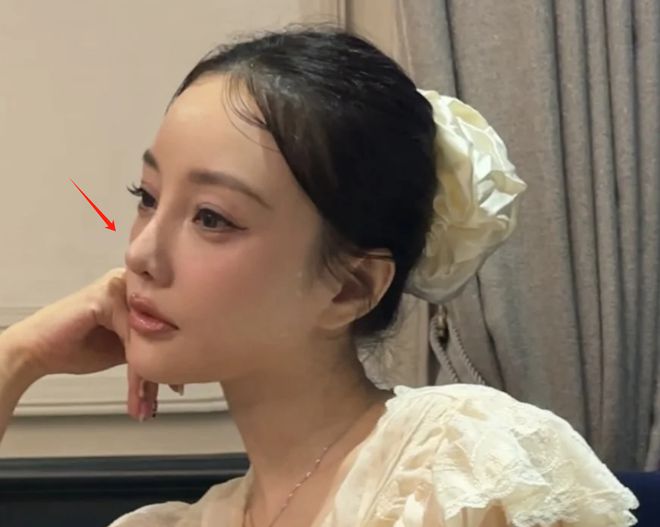 李小璐近照鼻头发黑泛红，43岁了还在追求少女感，彻底变成幼态脸