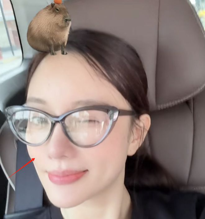 李小璐近照鼻头发黑泛红，43岁了还在追求少女感，彻底变成幼态脸