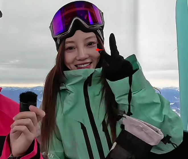 李小璐近照鼻头发黑泛红，43岁了还在追求少女感，彻底变成幼态脸