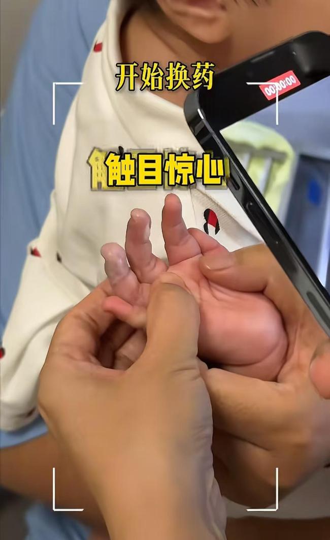 张纪中小女儿被保姆烫伤 意外事件引网友热议