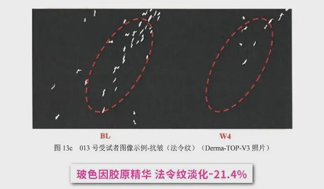 初代顶流男团F4合体，曾被群嘲最丑的他如今最吸睛？