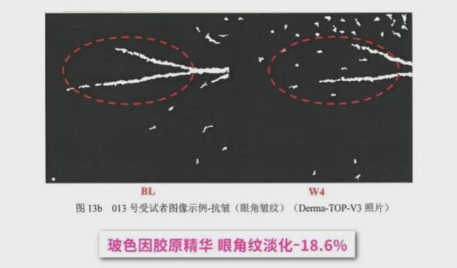 初代顶流男团F4合体，曾被群嘲最丑的他如今最吸睛？