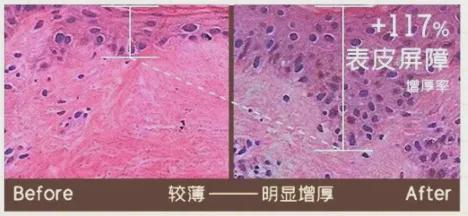 初代顶流男团F4合体，曾被群嘲最丑的他如今最吸睛？