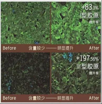 初代顶流男团F4合体，曾被群嘲最丑的他如今最吸睛？