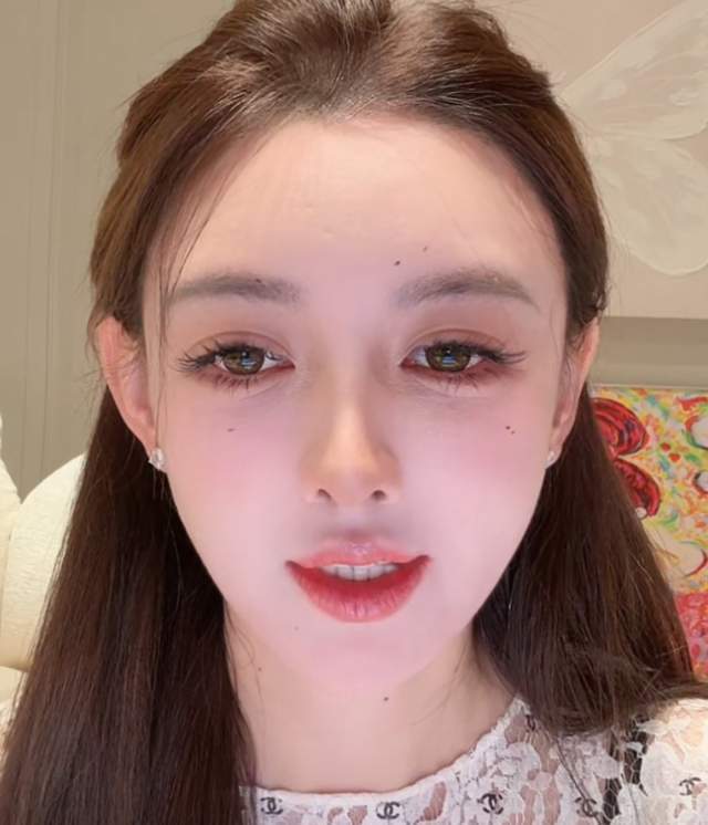 33岁叶珂真实状态曝光！眼袋细纹遮不住，医美后遗症好明显