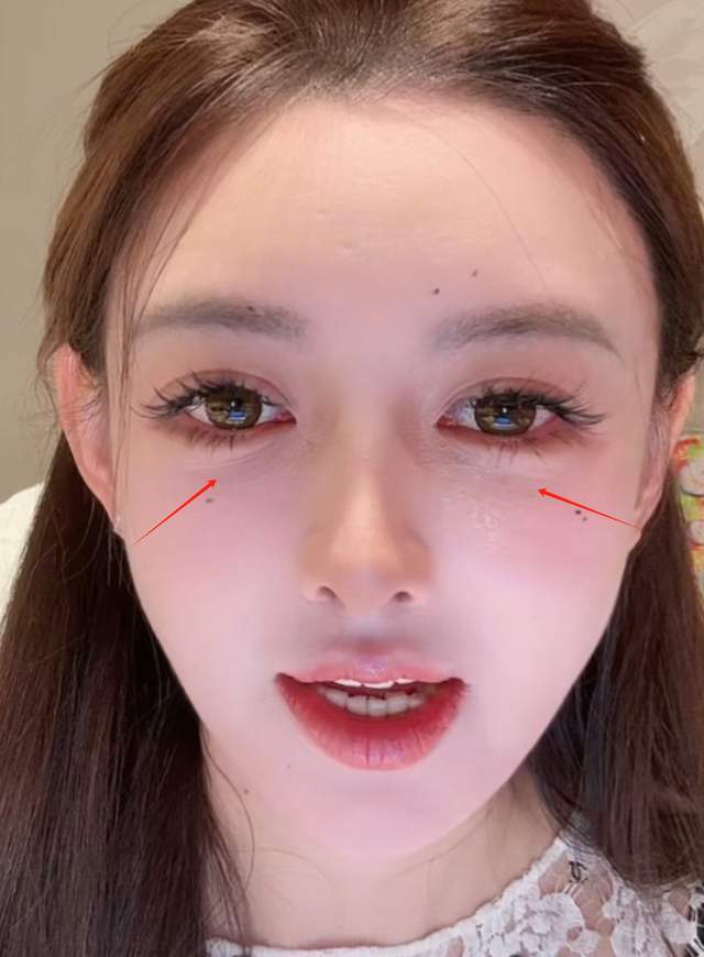 33岁叶珂真实状态曝光！眼袋细纹遮不住，医美后遗症好明显
