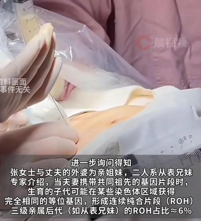E句话 | 寄居蟹永远没有代表作？