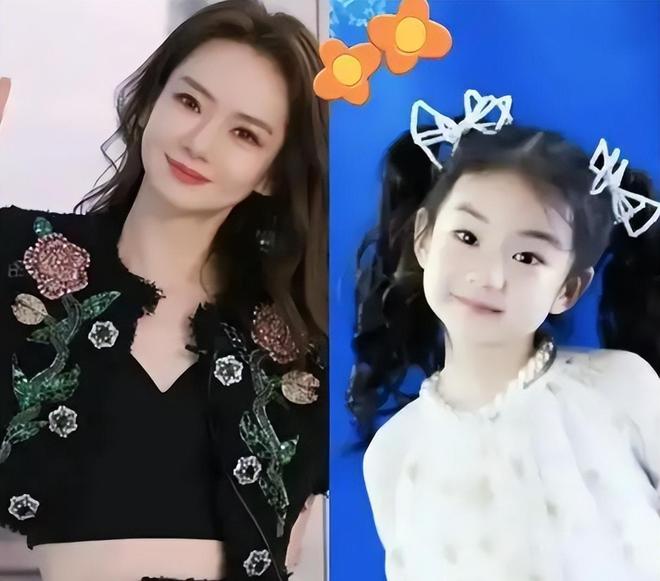 戚薇大方承认医美过度，整个眉毛动不了，网友不批评却夸她够真诚
