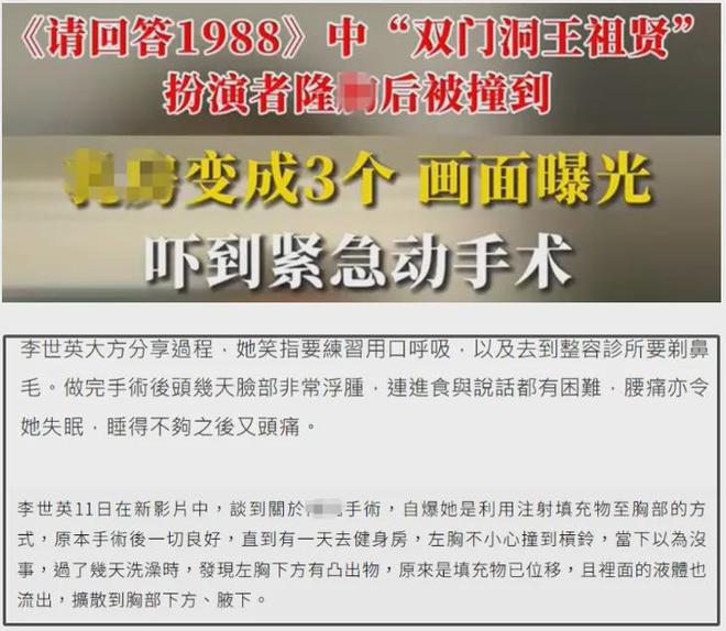 越来越多女星承认整容！有人后悔有人上瘾，动了28次手术停不下来