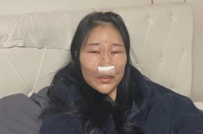 越来越多女星承认整容！有人后悔有人上瘾，动了28次手术停不下来