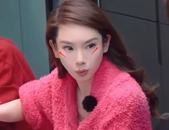越来越多女星承认整容！有人后悔有人上瘾，动了28次手术停不下来