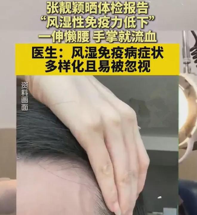 多位明星自曝身体出状况，有人吃素有人暴瘦，网友劝他们好好吃饭