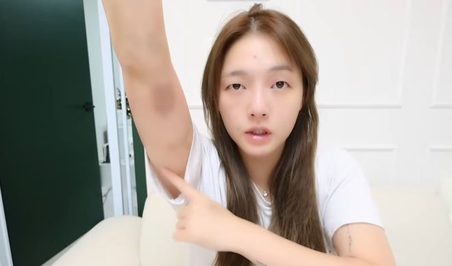 46万粉网红在韩国遭殴打，拒绝搭讪被打到浑身淤青，手指都骨折了