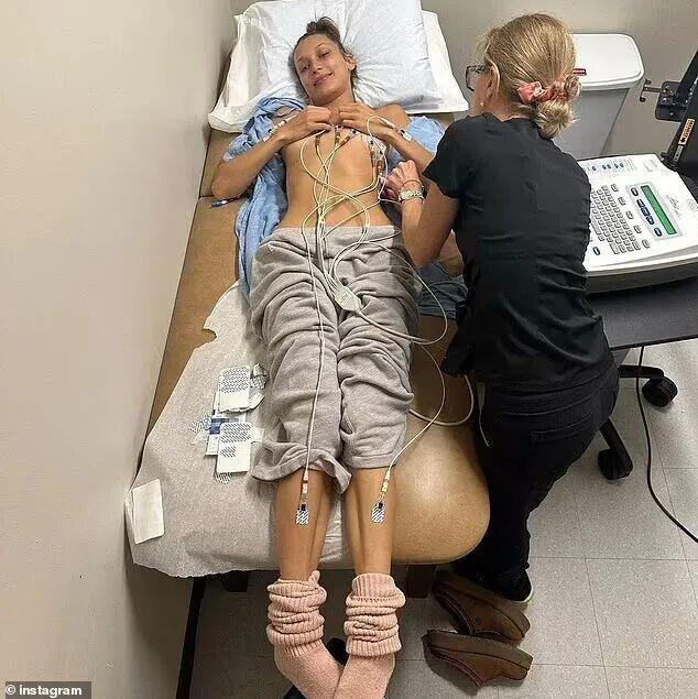 超模贝拉消失T台，进医院了？？满床管子满床药，这么严重？