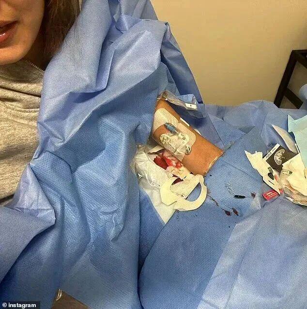 超模贝拉消失T台，进医院了？？满床管子满床药，这么严重？