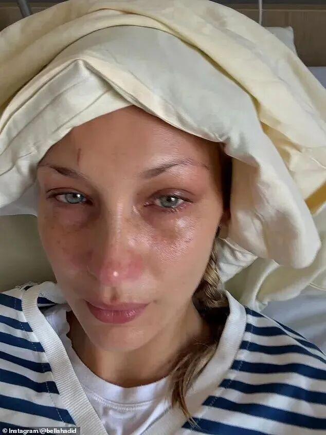 超模贝拉消失T台，进医院了？？满床管子满床药，这么严重？