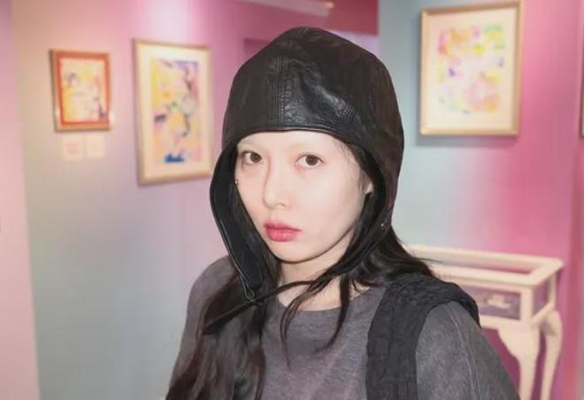 泫雅婚后状态越来越差，和丈夫同框一脸病容，社媒内容惹人担忧