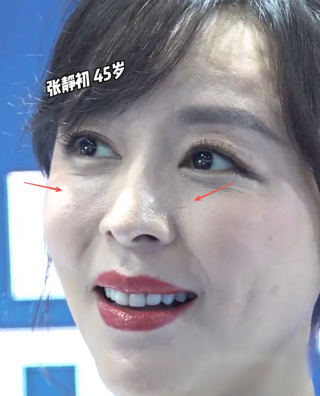 45岁张静初状态好真实！长期吃素气色差，生图毛孔粗大皱纹明显